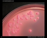klebsiella on macconkey agar